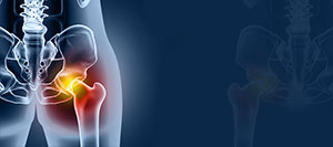 Hip Pain Treatment Specialist Near Me in Rapid City SD