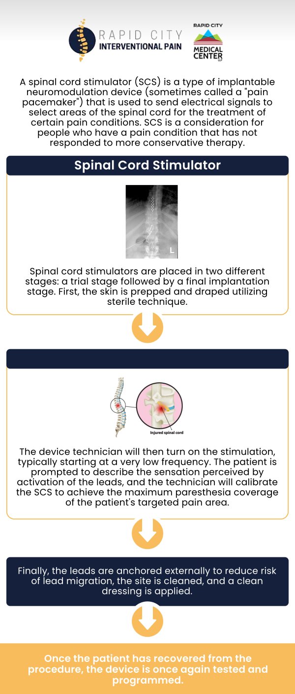 Common questions asked by patients: What exactly does a spinal cord stimulator do? How spinal cord stimulator work? What is the success rate of the spinal cord stimulator? Why would someone need a spinal cord stimulator? For more information, contact us to book an appointment. We are conveniently located at 101 E Minnesota St. Rapid City, SD 57701. We serve patients from Rapid City SD, Rapid Valley SD, Black Hawk SD, Box Elder SD, and surrounding areas.