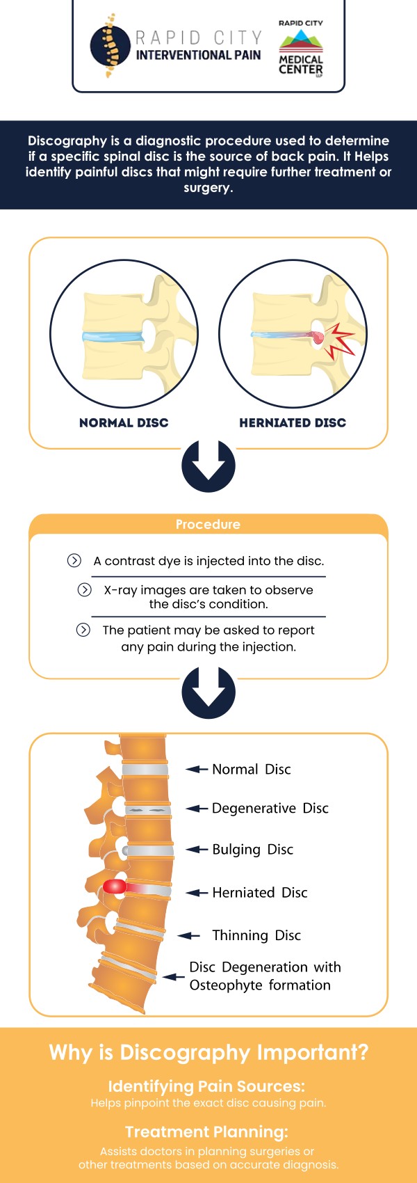Common questions asked by patients: What is functional anesthetic discography? Who needs functional anesthetic discography? What is the purpose of functional anesthetic discography? How much time does functional anesthetic discography take? For more information, contact us to book an appointment, We are conveniently located at 101 E Minnesota St. Suite 301 Rapid City, SD 57701. We serve patients from Rapid City SD, Rapid Valley SD, Black Hawk SD, Box Elder SD, and surrounding areas. Common questions asked by patients: What is functional anesthetic discography? Who needs functional anesthetic discography? What is the purpose of functional anesthetic discography? How much time does functional anesthetic discography take? For more information, contact us to book an appointment, We are conveniently located at 101 E Minnesota St. Suite 301 Rapid City, SD 57701. We serve patients from Rapid City SD, Rapid Valley SD, Black Hawk SD, Box Elder SD, and surrounding areas.