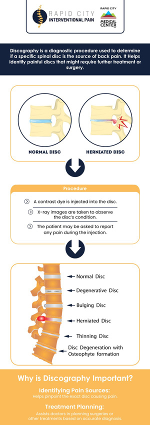 Common questions asked by patients: What is functional anesthetic discography? Who needs functional anesthetic discography? What is the purpose of functional anesthetic discography? How much time does functional anesthetic discography take? For more information, contact us to book an appointment, We are conveniently located at 101 E Minnesota St. Suite 301 Rapid City, SD 57701. We serve patients from Rapid City SD, Rapid Valley SD, Black Hawk SD, Box Elder SD, and surrounding areas. Common questions asked by patients: What is functional anesthetic discography? Who needs functional anesthetic discography? What is the purpose of functional anesthetic discography? How much time does functional anesthetic discography take? For more information, contact us to book an appointment, We are conveniently located at 101 E Minnesota St. Suite 301 Rapid City, SD 57701. We serve patients from Rapid City SD, Rapid Valley SD, Black Hawk SD, Box Elder SD, and surrounding areas.