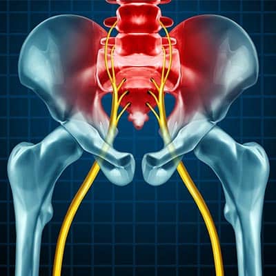 Nerve pain Near Me in Rapid City, SD